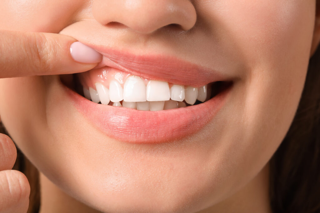 Igiene dentale a Lanciano - D'Autilio Studio Odontoiatrico