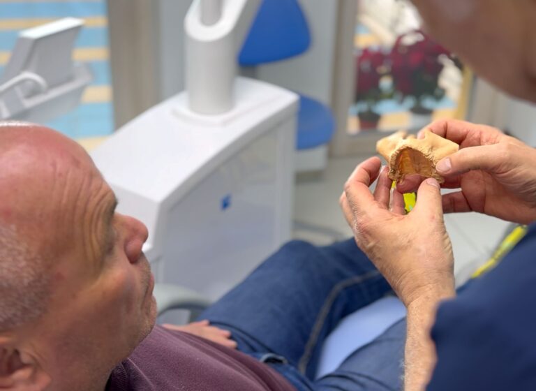 Impianto dentale a Lanciano - impianti dentali - glossario implantologia dentale - Differenza tra dentiera e impianto dentale - Cerchi uno studio dentistico a Fossacesia