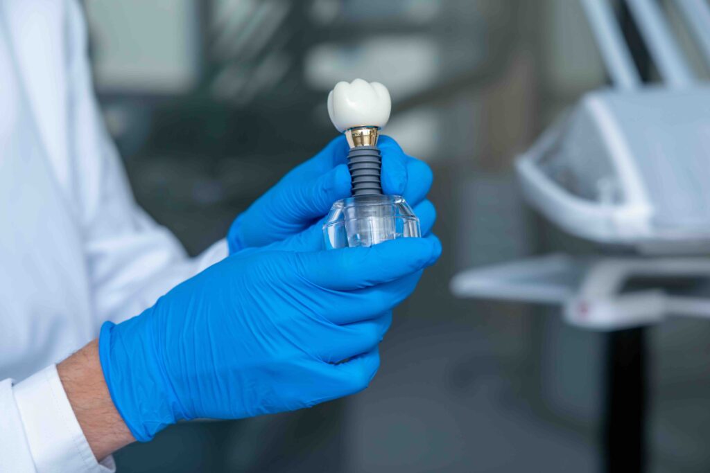materiali più usati per gli impianti